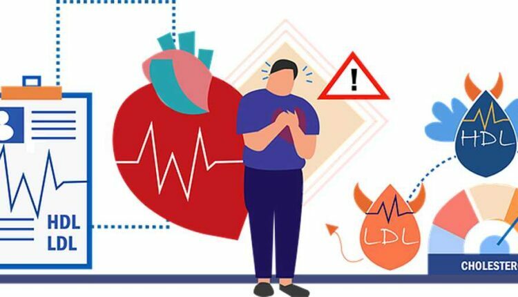 What Type of Cardio Is Right